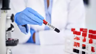 ВИЧ в алматинской больнице: как могли заразиться пациенты, рассказала главный санврач