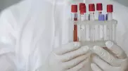 Ситуация нестабильная: в Алматы растет количество заболевших корью