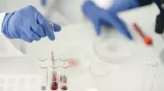 12 человек заразились сибирской язвой в Жамбылской области