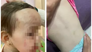 Девочка получила травмы в частном детсаду Павлодара