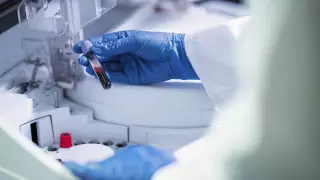 Больше 1300 случаев кори регистрируют в Казахстане еженедельно