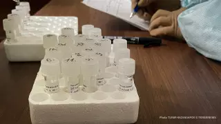 37 случаев: в каких регионах Казахстана выявили сибирскую язву