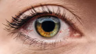 60 червей извлекли врачи из глаз женщины