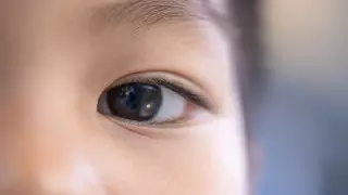 ИИ научили выявлять аутизм у детей по глазам