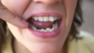 Не алкоголь и не кофе. Стоматолог назвал худший напиток для здоровья зубов