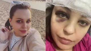 "Хотел скинуть с балкона": астанчанку в подъезде жестоко избил неизвестный