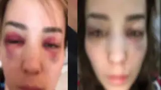 "Жила в аду": страдающая от преследований мужа казахстанка пожаловалась на полицейских