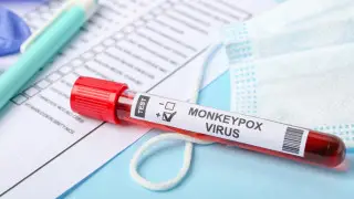 Обезьянья оспа мутировала и стала легче распространяться среди людей - ученые