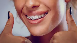 Беззубым казахстанцам "устанавливали" брекеты за счет пенсионных