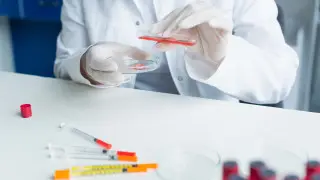 Вероятность появления оспы обезьян в Казахстане оценил Минздрав