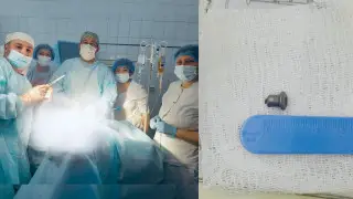 Шип от автомобильной шины вытащили из сердца казахстанца