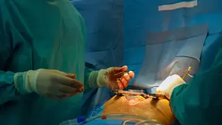 Энергетики разъели желудок подростку в Кокшетау: врачи показали видео