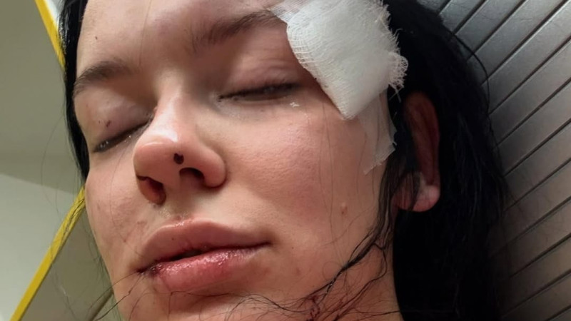 Фото: instagram/lamibrows_tigrees