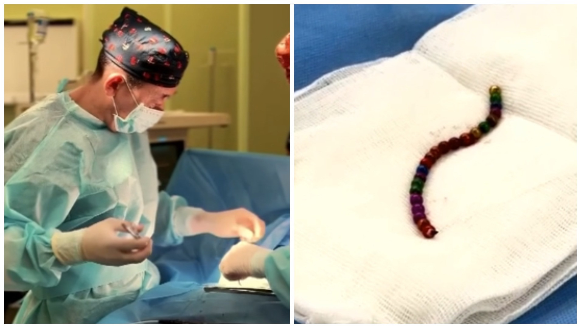 Ребенок проглотил 22 магнита в Караганде - врачи успели его спасти