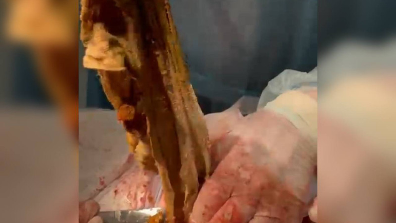 Кадры из видео юриста Анны Черновой