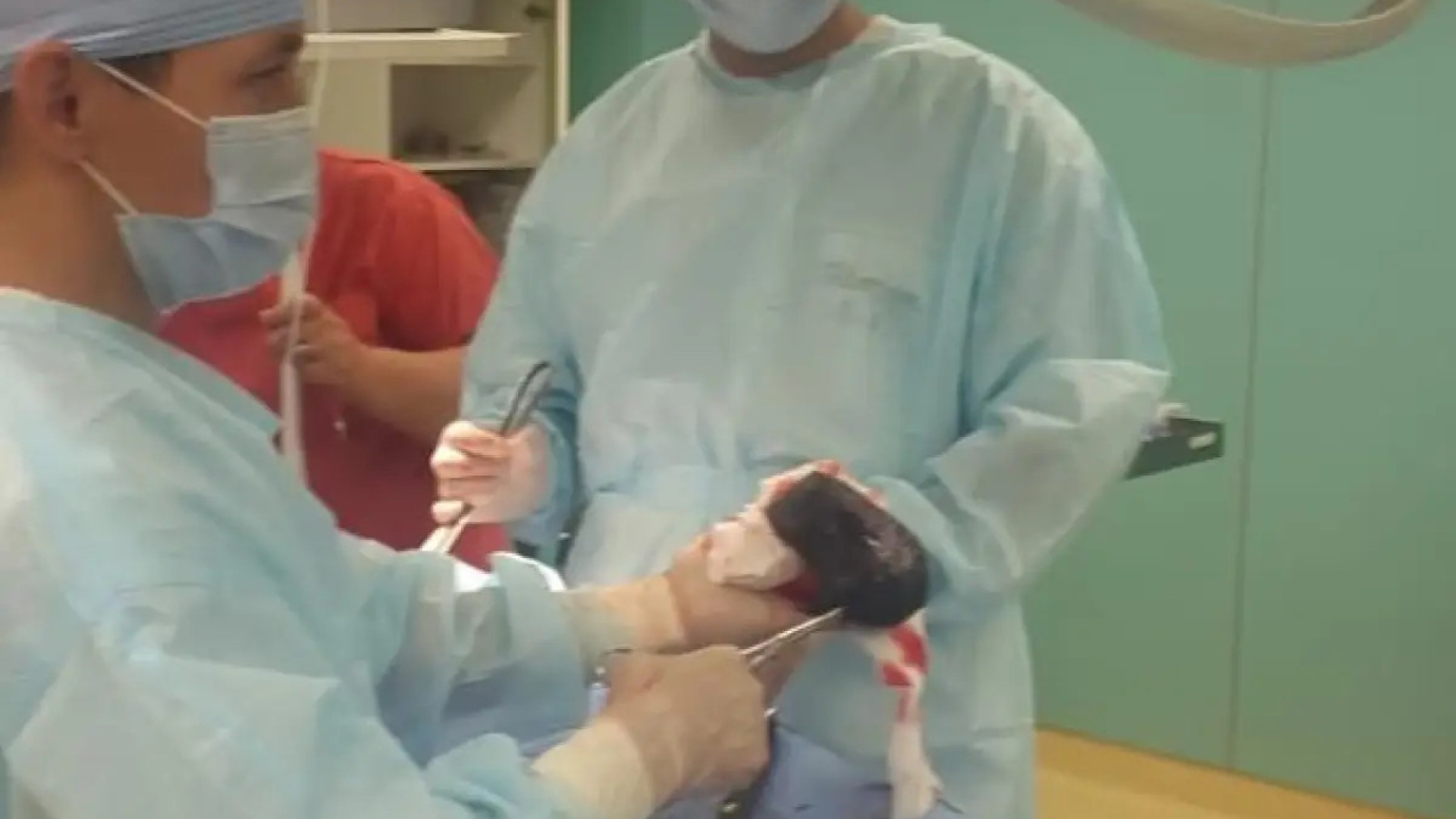 Огромный трихобезоар вытащили из желудка пациентки в Алматы