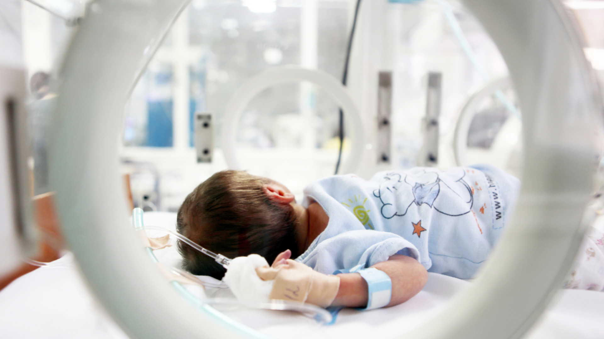 недоношенный ребенок